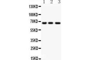 Observed bind size: 64KD (NF-kB p65 Antikörper  (AA 99-551))