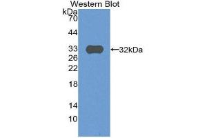 Western Blotting (WB) image for anti-Complement Component C9 (C9) (AA 22-265) antibody (ABIN3206005) (C9 Antikörper  (AA 22-265))