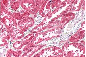 ABIN5539547 (5µg/ml) staining of paraffin embedded Human Kidney. (Ketohexokinase Antikörper  (Internal Region))
