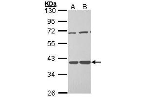 WB Image Sample (30 ug of whole cell lysate) A: H1299 B: Hela 10% SDS PAGE antibody diluted at 1:1000 (TSTA3 Antikörper  (C-Term))