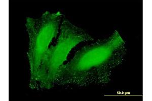 Immunofluorescence of purified MaxPab antibody to NETO2 on HeLa cell.