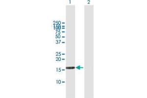 DUSP22 Antikörper  (AA 1-184)