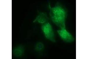 Image no. 2 for anti-Musashi Homolog 1 (Drosophila) (MSI1) antibody (ABIN1499574) (MSI1 Antikörper)