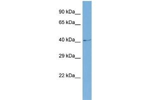 Host:  Rabbit  Target Name:  SLC6A5  Sample Type:  COLO205 Whole cell lysates  Antibody Dilution:  1. (SLC6A5 Antikörper  (N-Term))