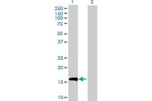 Western Blot analysis of IL10 expression in transfected 293T cell line by IL10 MaxPab polyclonal antibody.