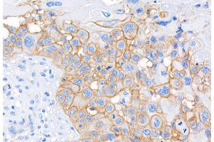 Immunohistochemistry (IHC) image for anti-CD44 (CD44) (AA 692-742) antibody (ABIN7453578) (CD44 Antikörper  (AA 692-742))