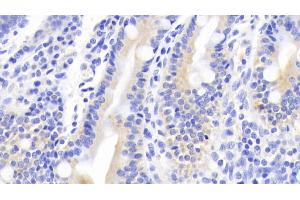 Detection of MUC5B in Human Small intestine Tissue using Polyclonal Antibody to Mucin 5 Subtype B (MUC5B) (MUC5B Antikörper  (AA 5366-5444))