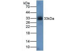 Figure. (CDK4 Antikörper  (AA 6-295))