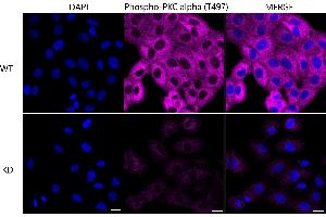 Immunocytochemical staining of HT- cells using Phospho-PKC alpha (T497) antibody (ABIN7799986), 1:1,000), Top panel: wild-type (WT), Bottom panal: Phospho-PKC alpha (T497) shRNA knockdown (KD).