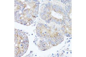 Immunohistochemistry (Paraffin-embedded Sections) (IHC (p)) image for anti-ATG5 Autophagy Related 5 (ATG5) (AA 1-275) antibody (ABIN3020674)