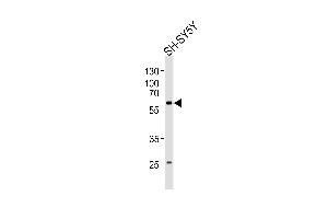 Western blot analysis of lysate from SH-SY5Y cell line, using PAK1 Antibody at 1:1000. (PAK1 Antikörper  (AA 241-275))