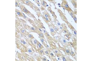 Immunohistochemistry of paraffin-embedded human liver using PPP4R1 antibody. (PPP4R1 Antikörper  (AA 324-647))