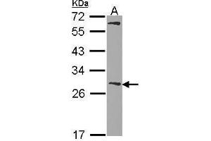 WB Image Sample (30 ug of whole cell lysate) A: Hela 12% SDS PAGE Glutathione S-transferase Mu 1 antibody antibody diluted at 1:1000 (GSTM1 Antikörper  (C-Term))