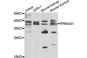 Western blot analysis of extracts of various cell lines, using PRKAG1 antibody. (PRKAG1 Antikörper)