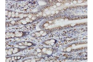 Image no. 1 for anti-Trans-Golgi Network Protein 2 (TGOLN2) (AA 229-328) antibody (ABIN599146) (TGOLN2 Antikörper  (AA 229-328))