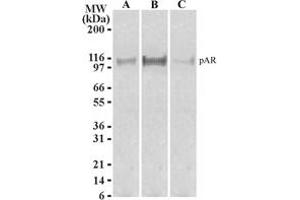 ATF6 Western Blot. (ATF6 Antikörper  (N-Term))