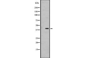 Western blot analysis of OR1I1 expression in MDA-MB231 cell line lysate ,The lane on the left is treated with the antigen-specific peptide. (OR1I1 Antikörper  (C-Term))