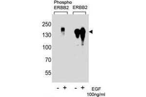 Western blot analysis of extracts from A431 cells, untreated or treated with EGF (100ng/ml) using phospho-ErbB2 antibody (left) or nonphos Ab (right)