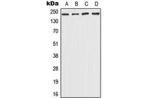 Western blot analysis of CHD5 expression in Hela (A), HepG2 (B), NIH3T3 (C), rat brain (D) whole cell lysates. (CHD5 Antikörper  (Center))