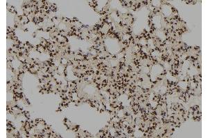 ABIN6278515 at 1/100 staining Rat lung tissue by IHC-P. (RFC3 Antikörper  (N-Term))