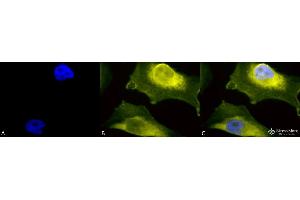 Immunocytochemistry/Immunofluorescence analysis using Rabbit Anti-SOD1 (UBB) Polyclonal Antibody . (SOD1 Antikörper  (N-Term) (PerCP))