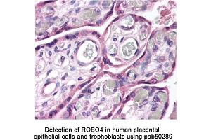 Image no. 2 for anti-Roundabout, Axon Guidance Receptor, Homolog 4 (ROBO4) (AA 900-1007), (C-Term) antibody (ABIN363598) (ROBO4 Antikörper  (C-Term))