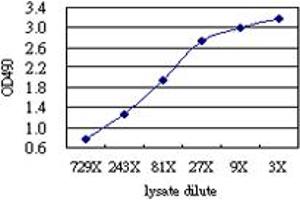 FCER1A (Human) Matched Antibody Pair