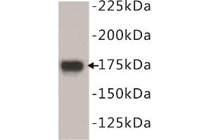 Western Blotting (WB) image for anti-Epidermal Growth Factor Receptor (EGFR) (N-Term) antibody (ABIN1854890) (EGFR Antikörper  (N-Term))