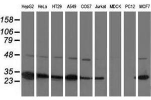 Western blot analysis of extracts (35 µg) from 9 different cell lines by using anti-SPR monoclonal antibody. (SPR Antikörper)