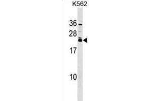 Western Blotting (WB) image for anti-Heart and Neural Crest Derivatives Expressed 2 (HAND2) antibody (ABIN2999145) (HAND2 Antikörper)