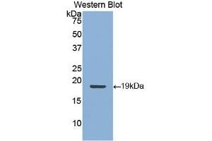 Detection of Recombinant KRT9, Human using Polyclonal Antibody to Cytokeratin 9 (CK9) (KRT9 Antikörper  (AA 315-456))