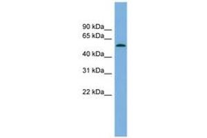 Image no. 1 for anti-Glucocorticoid Induced Transcript 1 (GLCCI1) (AA 179-228) antibody (ABIN6744984) (GLCCI1 Antikörper  (AA 179-228))