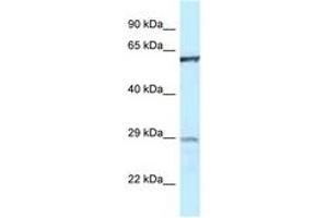 Image no. 1 for anti-Protein-tyrosine Phosphatase 1C (PTPN6) (AA 245-294) antibody (ABIN6747490) (SHP1 Antikörper  (AA 245-294))