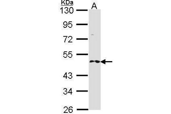 RNF25 Antikörper  (C-Term)