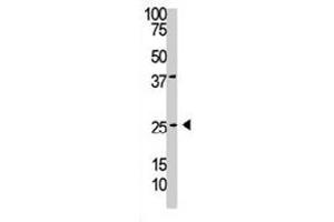 The PDGFB polyclonal antibody  is used in Western blot to detect PDGFC in A-375 cell lysate.