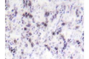 Immunohistochemistry analyzes of CREB antibody in paraffin-embedded human tonsil tissue. (CREB1 Antikörper)