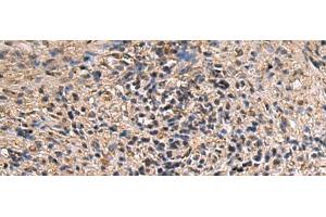 Immunohistochemistry of paraffin-embedded Human brain tissue using ITIH2 Polyclonal Antibody at dilution of 1:70(x200)