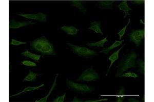 Immunofluorescence of monoclonal antibody to SFN on HeLa cell. (14-3-3 sigma/SFN Antikörper  (AA 1-248))