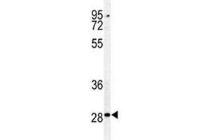 Image no. 6 for anti-Caspase 3 (CASP3) (AA 149-179) antibody (ABIN3030296)