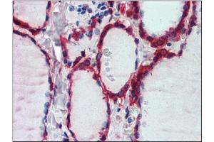 Immunohistochemistry: Human Thyroid: Formalin-Fixed, Paraffin-Embedded (FFPE) (Peroxiredoxin 1 Antikörper  (Internal Region))