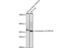 Western blot analysis of extracts of various cell lines, using Cytokeratin 19 (KRT19) (KRT19) antibody (ABIN7268099) at 1:1000 dilution. (Cytokeratin 19 Antikörper)