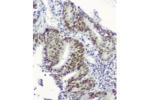 IHC analysis of RPA70 using anti-RPA70 antibody (ABIN6719369).