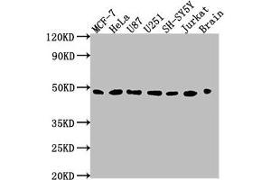 Western Blot Positive WB detected in: MCF-7 whole cell lysate, HeLa whole cell lysate, U87 whole cell lysate, U251 whole cell lysate, SH-SY5Y whole cell lysate, Jurkat whole cell lysate, Rat brain tissue All lanes: LOX antibody at 1:2000 Secondary Goat polyclonal to rabbit IgG at 1/50000 dilution Predicted band size: 47 kDa Observed band size: 47 kDa (LOX Antikörper  (AA 23-285))