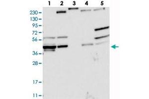 Western blot analysis of Lane 1: RT-4, Lane 2: U-251 MG, Lane 3: Human Plasma, Lane 4: Liver, Lane 5: Tonsil with AGPAT9 polyclonal antibody . (AGPAT9 Antikörper)