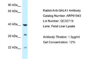 Western Blotting (WB) image for anti-Galactokinase 1 (GALK1) (C-Term) antibody (ABIN786519) (GALK1 Antikörper  (C-Term))