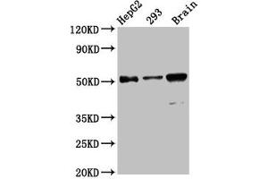 Western Blot Positive WB detected in: HepG2 whole cell lysate, 293 whole cell lysate, Mouse brain tissue All lanes: ZFP57 antibody at 13. (ZFP57 Antikörper  (AA 183-295))