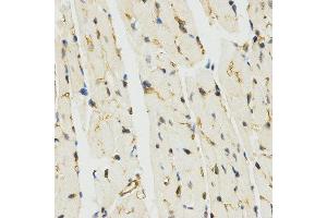 Immunohistochemistry (IHC) image for anti-Myb-Like, SWIRM and MPN Domains 1 (MYSM1) (C-Term) antibody (ABIN3017376) (MYSM1 Antikörper  (C-Term))