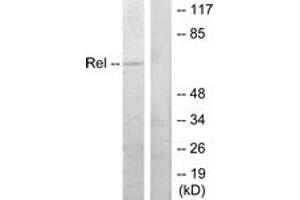 Western blot analysis of extracts from MDA-MB-435 cells, using Rel (Ab-503) Antibody. (c-Rel Antikörper  (AA 470-519))