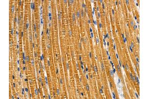 ABIN6259163 and ABIN6274159 at 1/100 staining Rat heart tissue by IHC-P. (TACSTD2 Antikörper  (Internal Region))