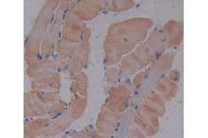 IHC-P analysis of Mouse Tissue, with DAB staining. (TNNI1 Antikörper  (AA 1-187))